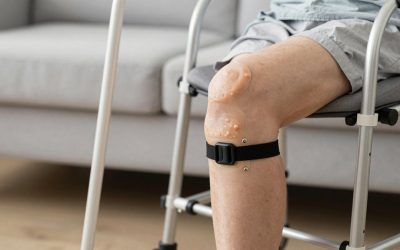 Best Cane for Knee Replacement Recovery
